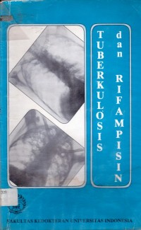 Tuberkulosis dan rifampisin