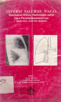 Infeksi Saluran Nafas Gambaran Klinis, Radiologis serta cara Penatalasanaannya (pada bayi, anak dan dewasa)