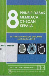 8 prinsip dasar membaca CT-Scan kepala
