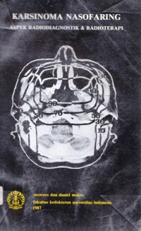 Karsinoma nasofaring : aspek radiodiagnostik & radioterapi