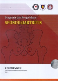 Diagnosis dan Pengelolaan Spondiloartritis