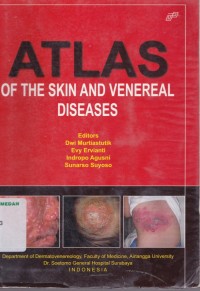 Atlas of the skin and venereal diseases