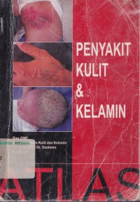 Atlas penyakit kulit & kelamin, cetakan 4