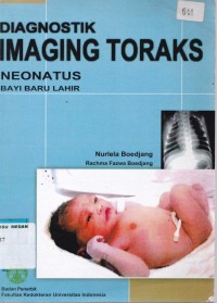 Diagnostik imaging toraks : neonatus bayi baru lahir