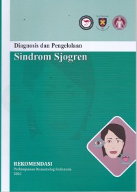 Diagnosis dan pengelolaan sindrom Sjogren