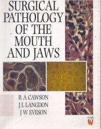 Surgical pathology of the mouth and jaws