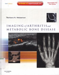 Imaging of arthritis and metabolic bone disease